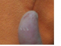 палец